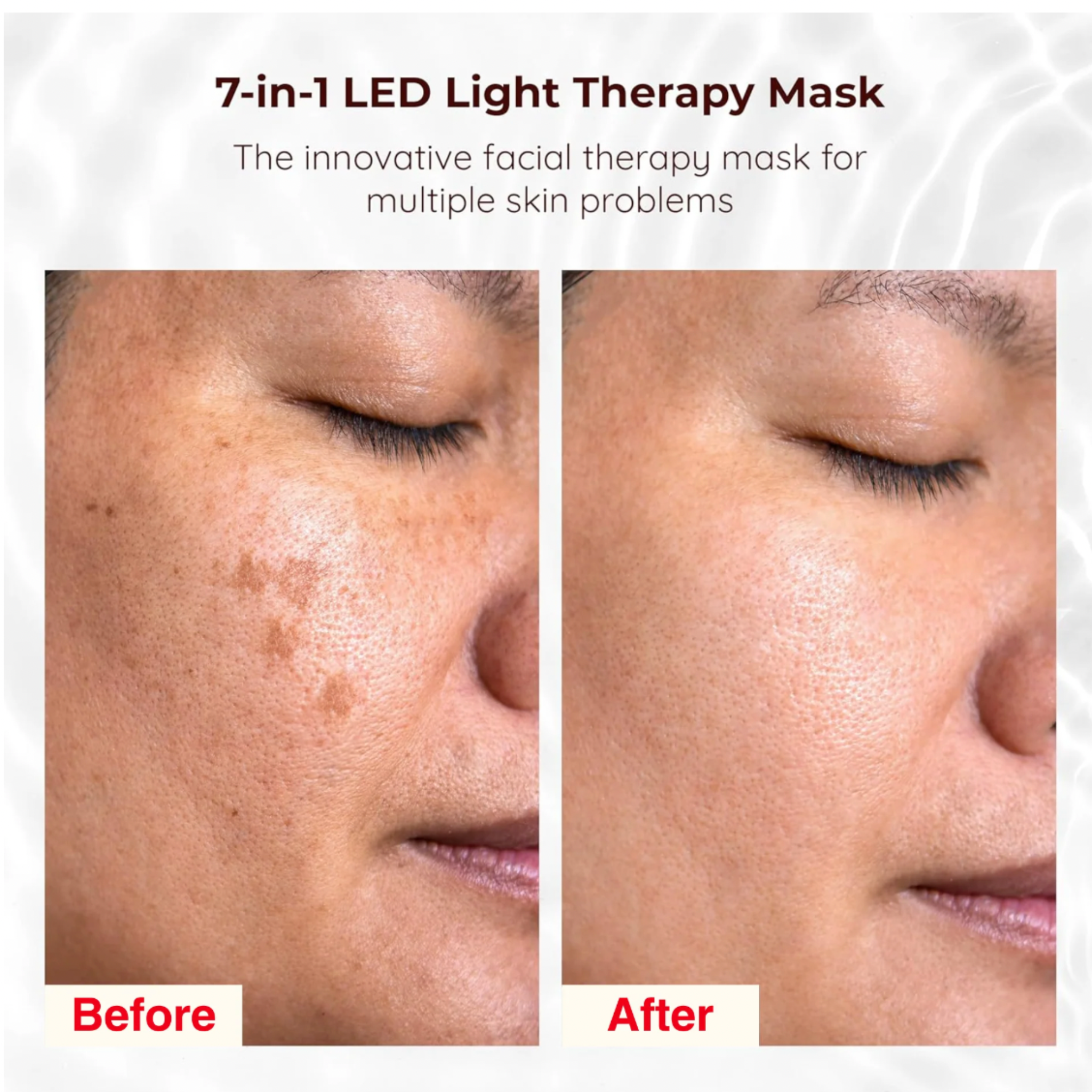 LumiRevive™: 7-Color LED Therapy for Radiant Skin