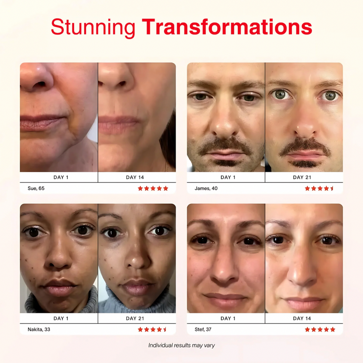 GlowLift™: Microcurrent Eye & Face Rejuvenation Massager