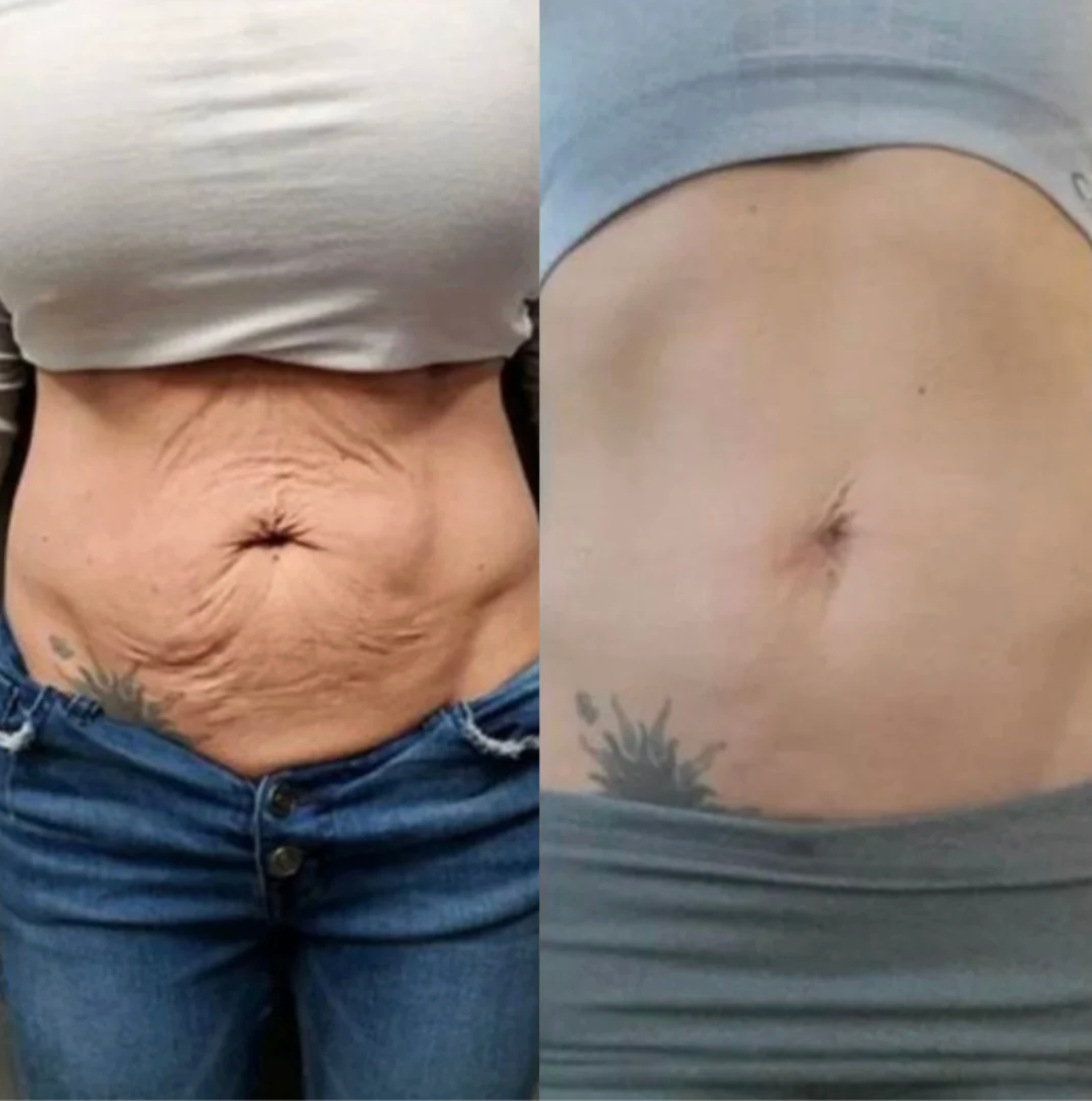 ThermaLight360™ - Pain Relief & Slimming Belt + Red Light Mastery Guide