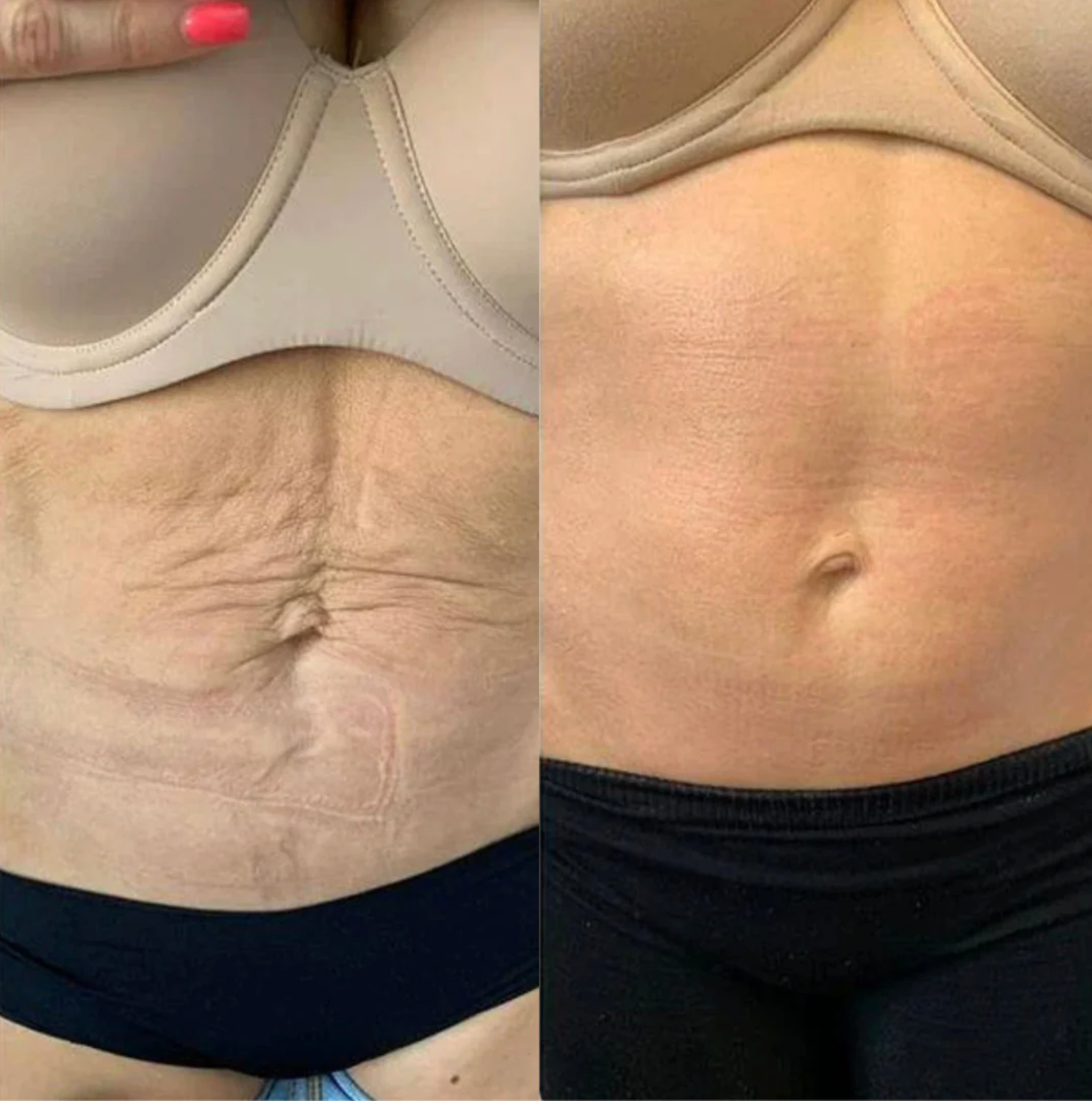 ThermaLight360™ - Pain Relief & Slimming Belt + Red Light Mastery Guide